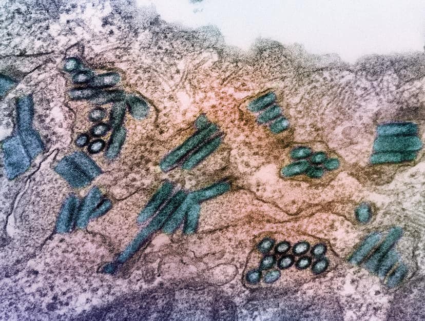 Ebola-Ausbruch im Kongo begann früher als erklärt, berichtet die WHO